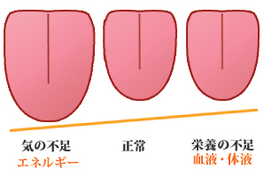 舌の大小