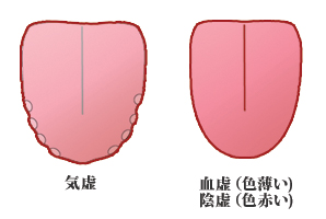 舌の硬さ・柔らかさ